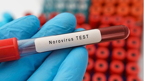 Norovirus, focolaio sulla Ruby Princess: oltre 120 contagiati in crociera tra Alaska e Canada