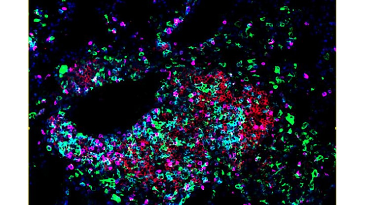 Identificate le cellule che costruiscono gli avamposti anticancro - Alto Adige