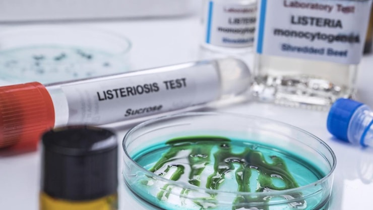 Listeria, perché in Europa aumentano i casi gravi: più anziani, cibi pronti e scarsa attenzione alle regole della conservazione - Corriere della Sera